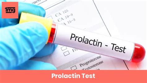 when to test prolactin